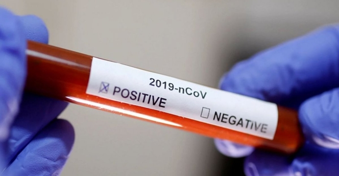 Bahia registra 160 novos casos de Covid-19 e mais 13 óbitos pela doença