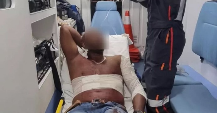 Homem alega que foi esfaqueado por “ser muito bonito”; entenda