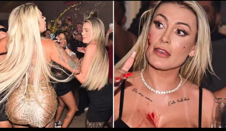 IMAGENS FORTES! Briga entre Andressa Urach e Juju Ferrari termina em sangue; veja vídeo