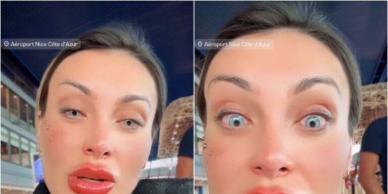 Andressa Urach se desespera e se arrepende por mudança na cor dos olhos: ‘orem por mim’