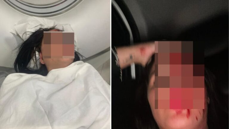 Briga por causa de perfume termina com jovem brutalmente agredida por quatro mulheres em Salvador