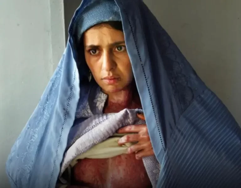 No Afeganistão, está autorizado, por lei, agredir a esposa. “Só não pode quebrar os ossos dela”