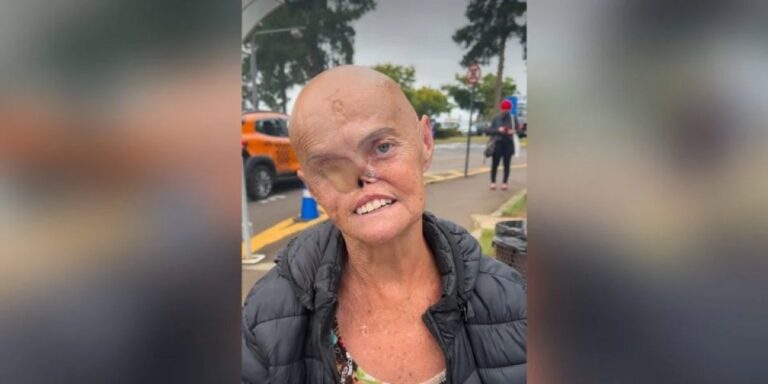 Mulher que teve 73 tumores comove ao contar história de superação contra o câncer