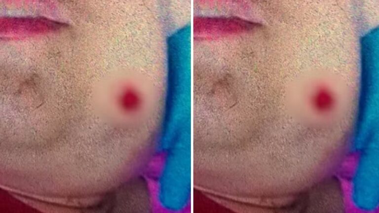 Jovem autista é baleada no rosto após sorrir para homem: “Está rindo da minha cara?”